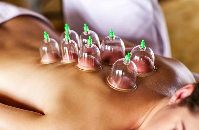 A woman receiving a relaxing Tranquil Healing massage enhanced with the use of glass cups on her back.