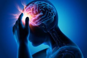 Severe Headache - Migraine